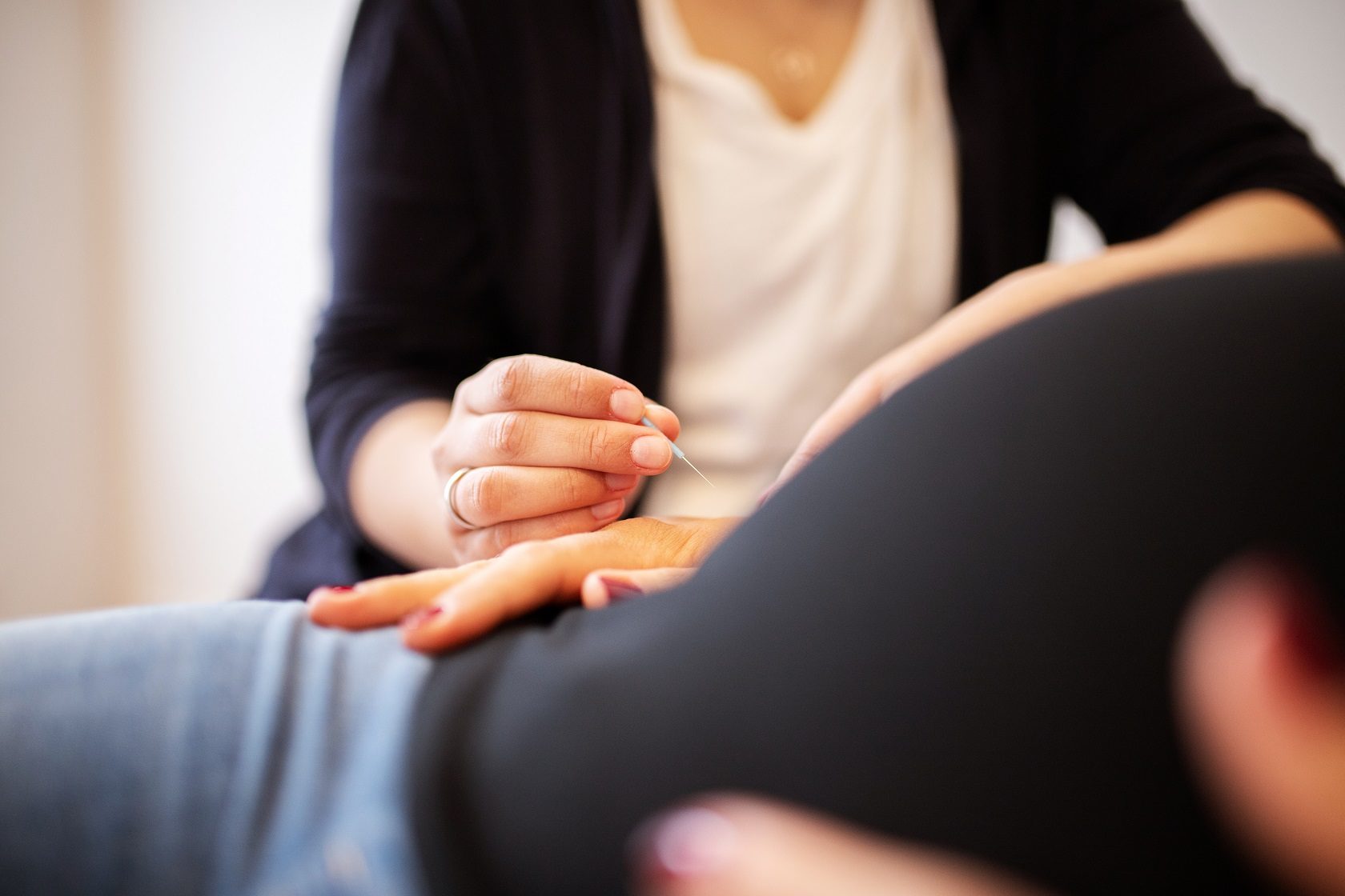 Akupunktur und Taping in der Geburtsvorbereitung